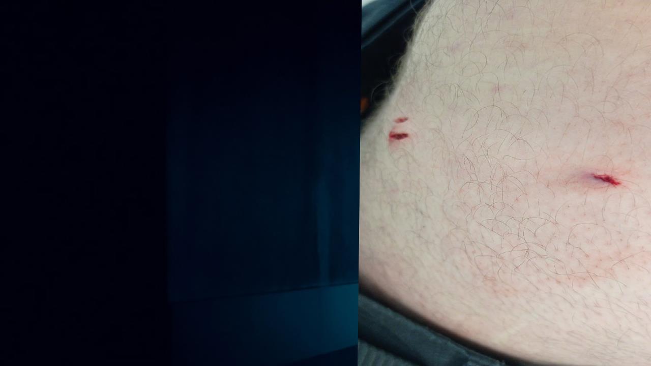 Τραυματισμός με μαχαίρι εργαζόμενου στο νοσοκομείο Χανίων [φωτογραφία]