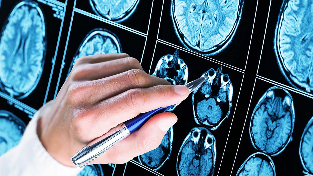 Ημερίδα  για το έργο «Διεγχειρητική Κυτταρομετρία Ροής σε Όγκους Εγκεφάλου: Εξατομικευμένη Χειρουργική Επέμβαση, MIS «5070923»