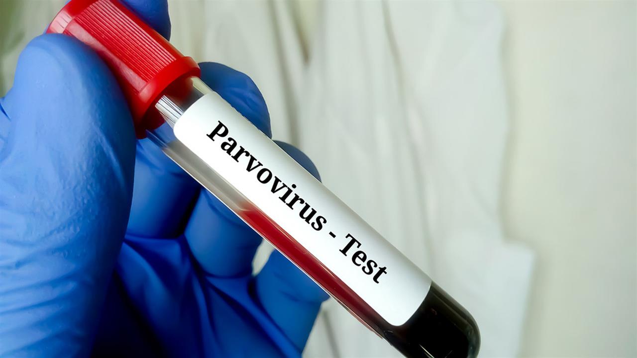 Παρβοϊός: Συμπτώματα, διάγνωση και αντιμετώπιση