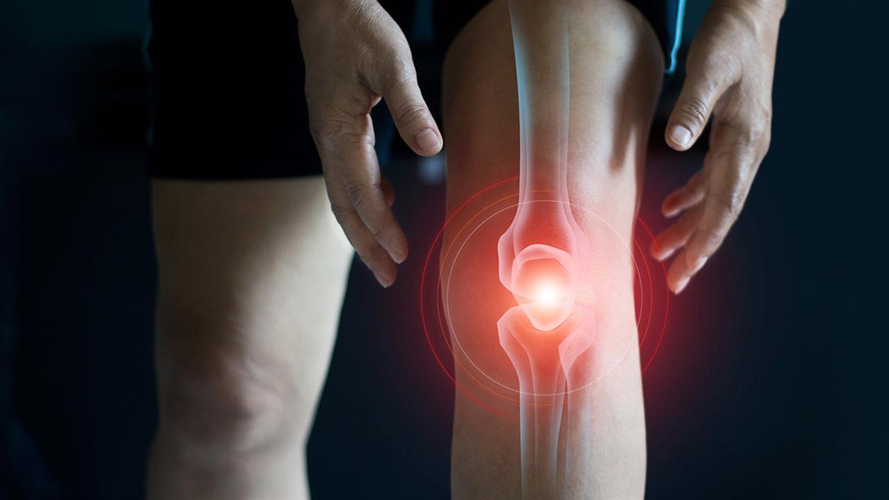 Πόνος στο γόνατο: Πότε χρειάζεται αρθροπλαστική