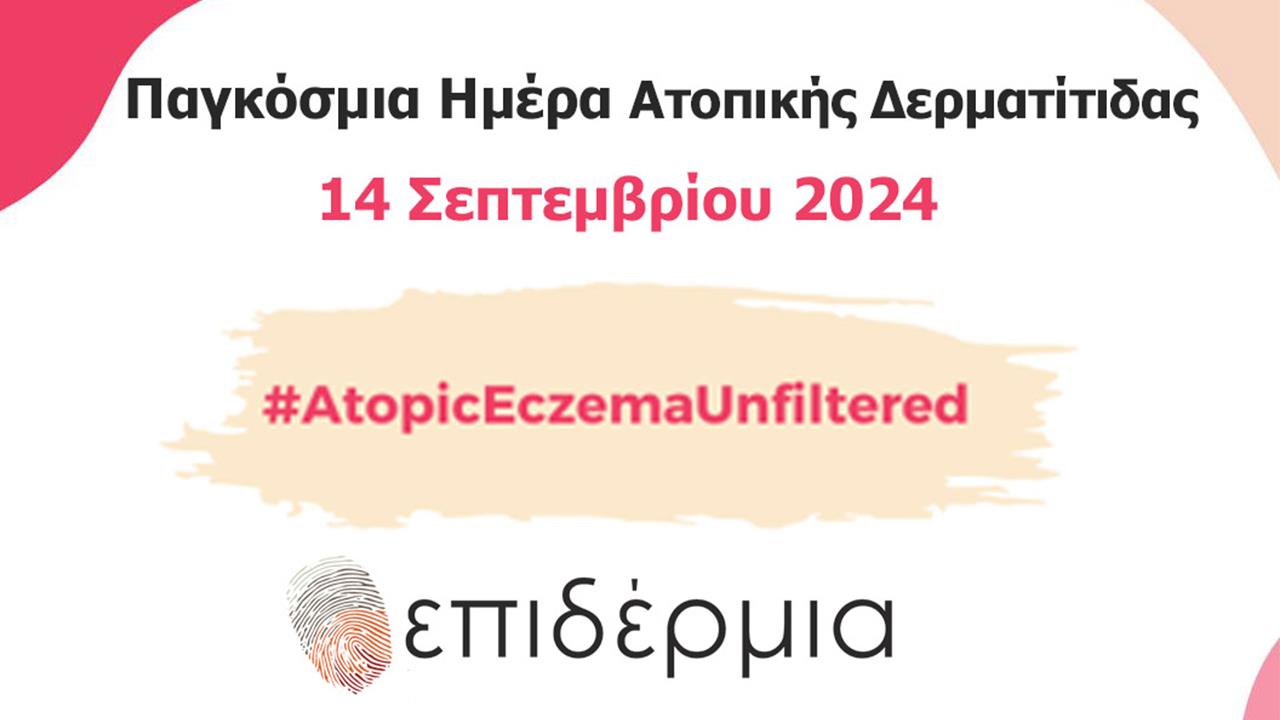 Παγκόσμια Ημέρα Ατοπικής Δερματίτιδας 2024: Ανοικτή ενημερωτική δράση στο κέντρο της Αθήνας