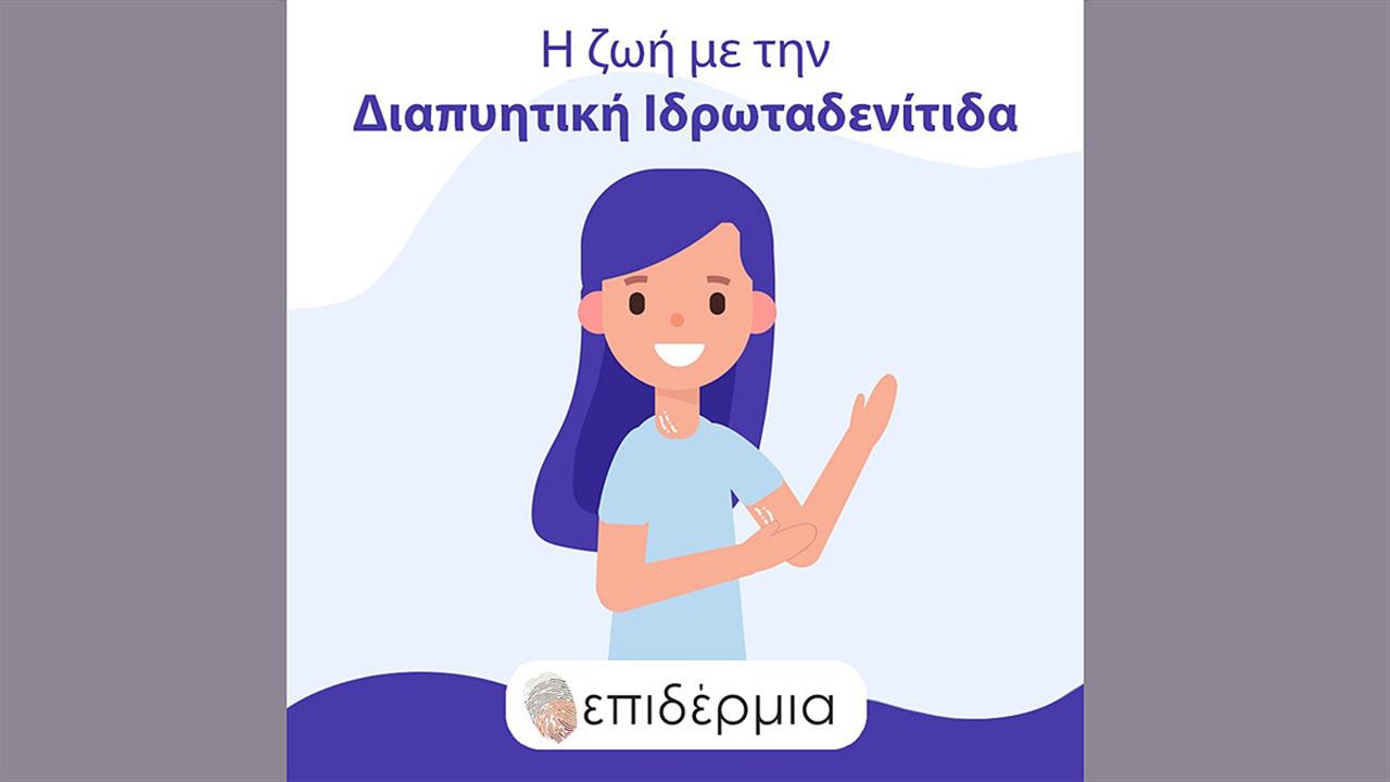 Καμπάνια ενημέρωσης και ευαισθητοποίησης για τη Διαπυητική Ιδρωταδενίτιδα από τον Πανελλήνιο Σύλλογο Ασθενών ‘’Eπιδέρμια’’