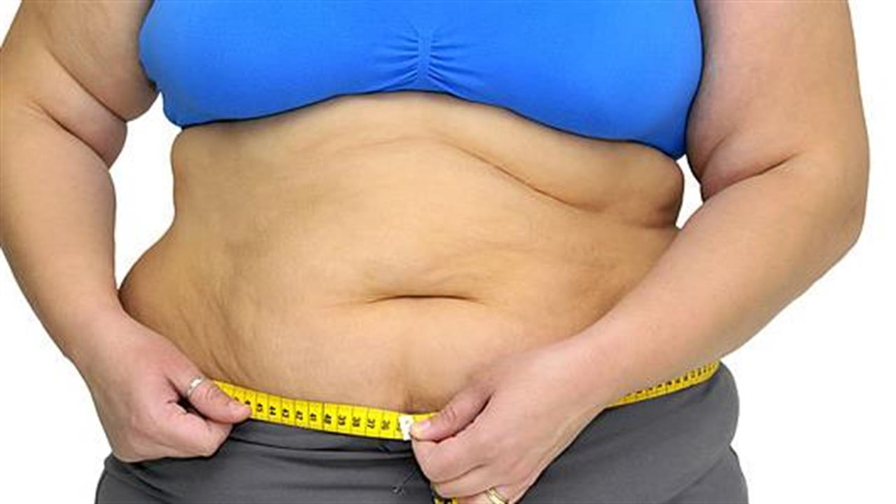 Νέα έρευνα συνδέει την παχυσαρκία με τον καρκίνο