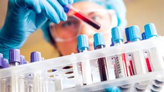 Πειραματική εξέταση αίματος εντοπίζει 12 είδη καρκίνου- και ορισμένους όγκους σε αρχικό στάδιο