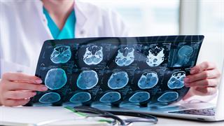 Πώς επηρέασε η πανδημία COVID-19 τους ασθενείς με όγκους εγκεφάλου