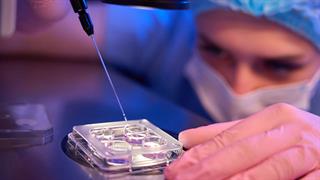 Βλαστοκύτταρα: Ταχύτερη μεταμόσχευση για λευχαιμία χάρη στην κρυοσυντήρηση