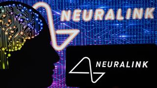 Neuralink: Εμφύτευσε τη συσκευή της και σε δεύτερο ασθενή