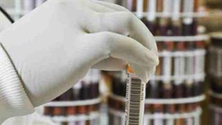Νέα αγωγή θα θεραπεύει μελλοντικά τον ιό HIV