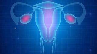 Μεταμόσχευση ωοθηκικού ιστού για γυναίκες με καρκίνο που θέλουν να αποκτήσουν παιδί