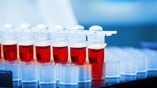 Έρευνα: Ετήσια εξέταση αίματος μπορεί να μειώσει τη θνησιμότητα από καρκίνο ωοθηκών