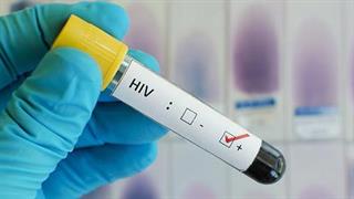 Ο ιός HIV μπορεί να κρύβεται στους ιστούς και μετά την αντιρετροϊκή αγωγή