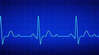ΕΚΕ : Δωρεά φορητών καρδιογράφων σε Κέντρα Υγείας και Υπερηχογράφων «παλάμης» στα νοσοκομεία αναφοράς